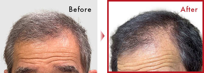 手軽にでき、使いやすい。