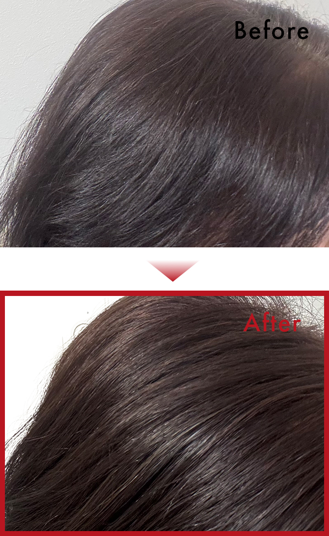 ほぼ毎日使っていました。シャンプーもカラーもできて髪質が変わりました。のサムネイル