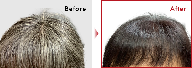生え際も後頭部の髪の毛も綺麗に毎日色が入っているので自分に自信が持てるようになりました。