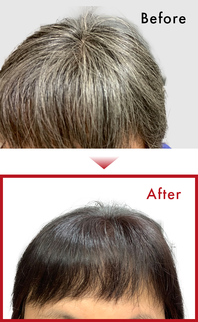 生え際も後頭部の髪の毛も綺麗に毎日色が入っているので自分に自信が持てるようになりました。のサムネイル