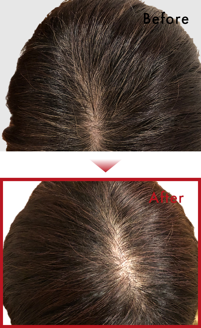 一回使用しただけで色着いたのでとても満足できました。のサムネイル