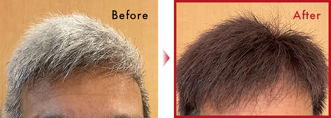 始めて数日はなかなか色着きませんでした。が、続ける事でいい感じに染まりました。