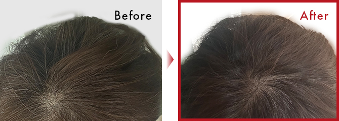 以前より髪質が良くなった気がします。