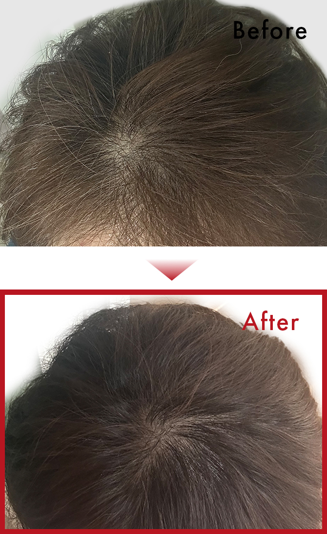 以前より髪質が良くなった気がします。のサムネイル