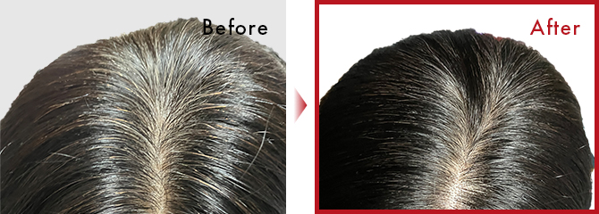 毛染めをやめて、面倒くささがなくなった。薄毛が減少した。