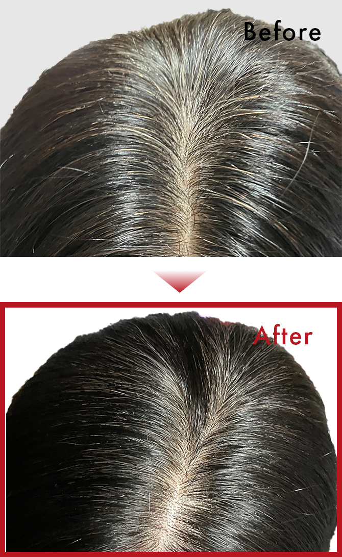 毛染めをやめて、面倒くささがなくなった。薄毛が減少した。のサムネイル