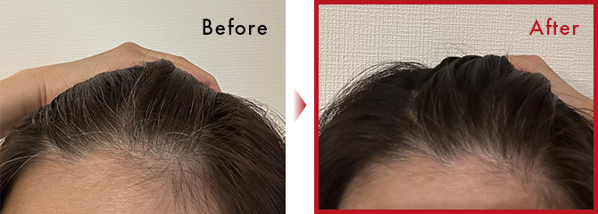 使用後1週間で生え際の白髪が気にならなくなり、嬉しくて姿勢や肌ケアにも気をつけるようになりました。