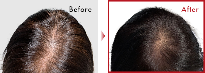 続けて使用出来れば白髪もそれほど気にせず過ごせそうなので、頑張ってみようと思います。