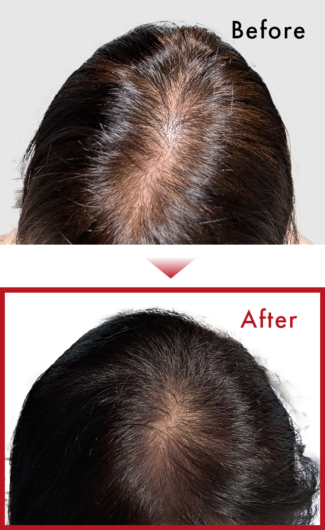 続けて使用出来れば白髪もそれほど気にせず過ごせそうなので、頑張ってみようと思います。のサムネイル