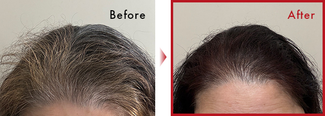 白髪が少なくなってきたので嬉しいです。