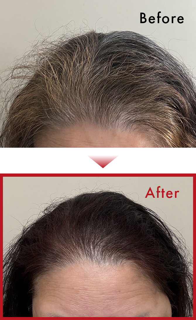 白髪が少なくなってきたので嬉しいです。のサムネイル