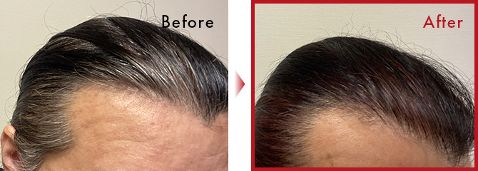 この類いのシャンプーの中でトップクラスの色着き具合です。