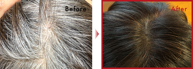 友人に勧められ使用したところ全く痒みもなく、しかも根元からちゃんと色着きます。