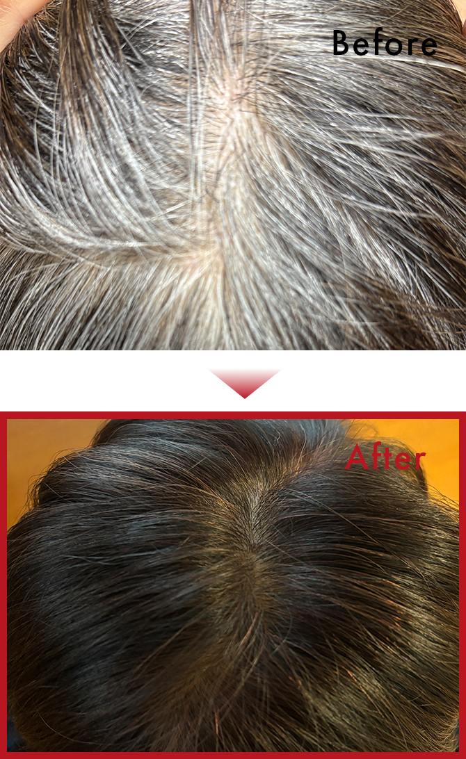 友人に勧められ使用したところ全く痒みもなく、しかも根元からちゃんと色着きます。のサムネイル