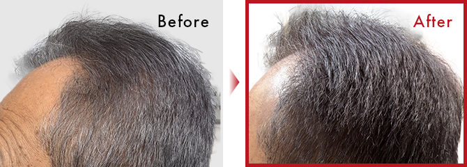 1ヶ月の使用中に２日ほど使用出来なかったが色に変化もなくしっかりカラーをキープしてくれた！