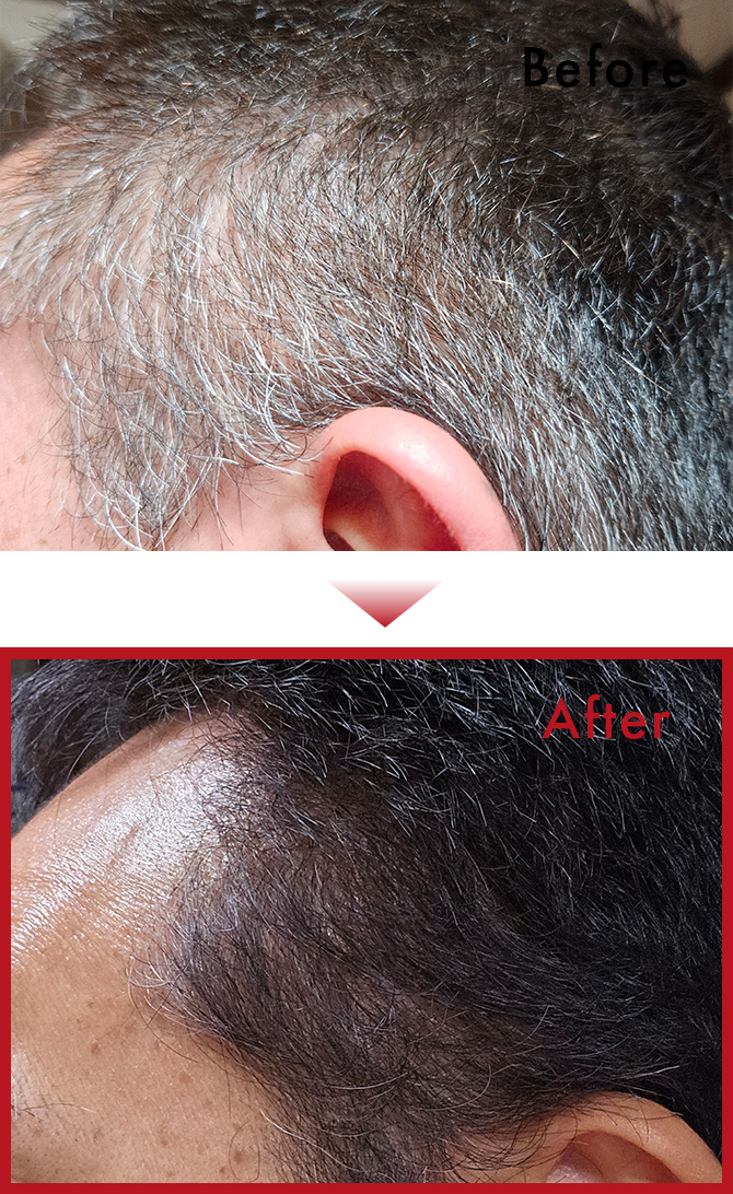 シャンプーするだけなので、とてもいい。のサムネイル