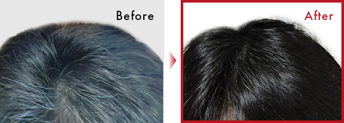 髪に艶が出てきて白髪が目立たなくなってきた。