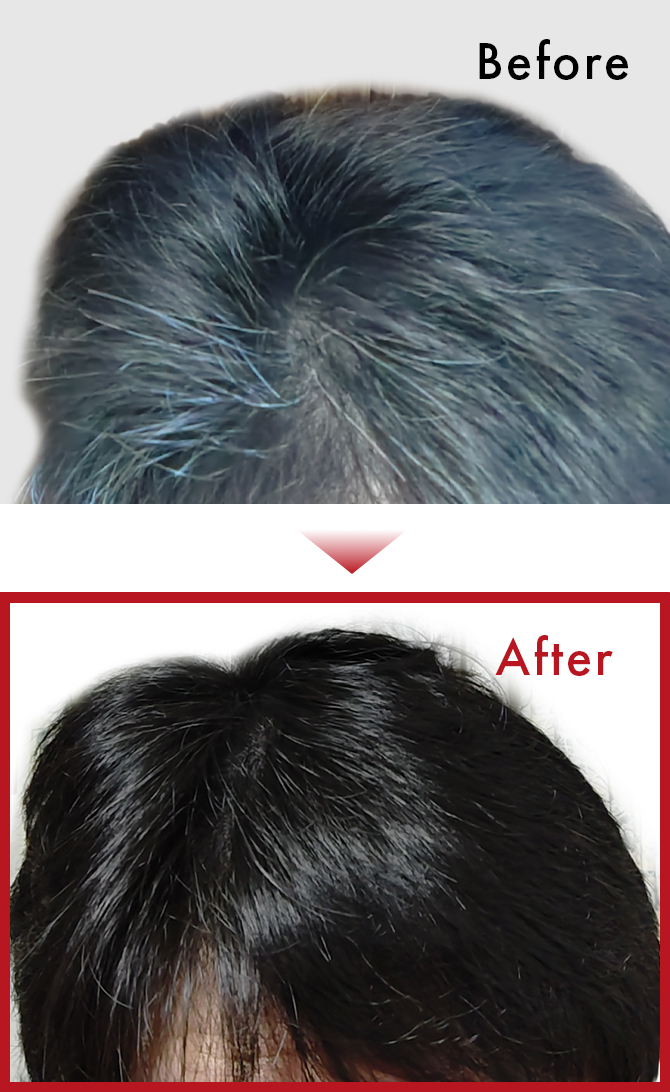 髪に艶が出てきて白髪が目立たなくなってきた。のサムネイル